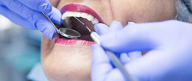 Best Same-Day Emergency Dental Services in Morro Bay, CA