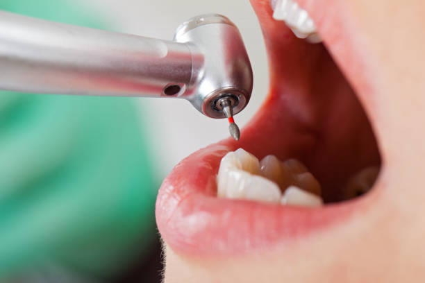 Best Pediatric Emergency Dentist in Morro Bay, CA